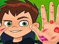 遊戲Ben10手形醫生 在線 遊戲Ben10手形醫生 在線