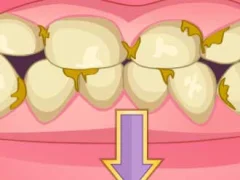 遊戲Bad Teeth Makeover在線