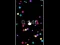 遊戲Pop Ball在線