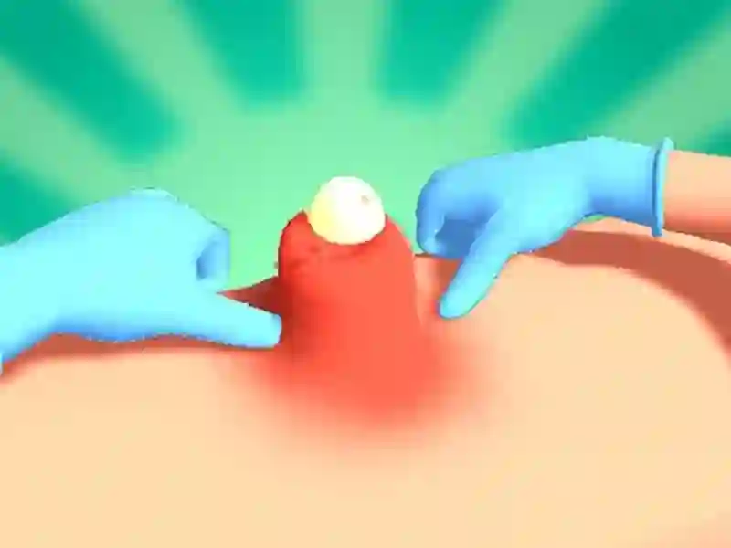 遊戲Pimple Squeeze在線