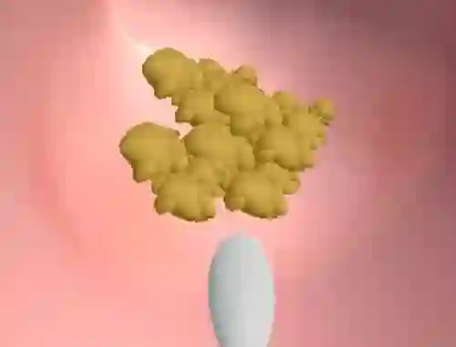 遊戲Earwax Clinic在線