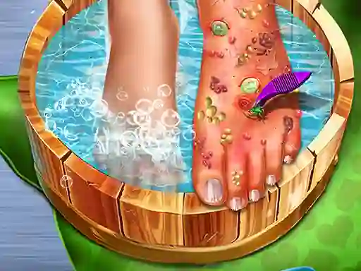 遊戲Feet Skin Doctor在線