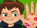 遊戲Ben10手形醫生 在線